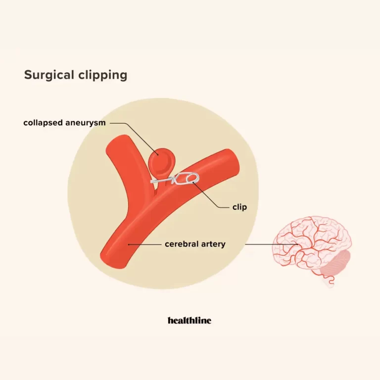 Aneurysm Repair Procedure