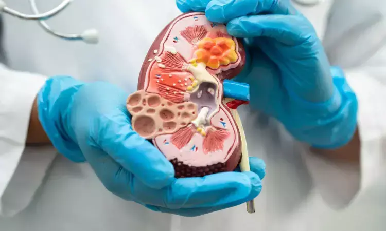 Kidney transplant surgery in India for UAE patients 2025