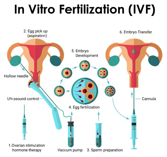 Affordable IVF Treatment in India for Sri Lanka Patients 2025 – High Success Rates & World-Class Fertility Care.